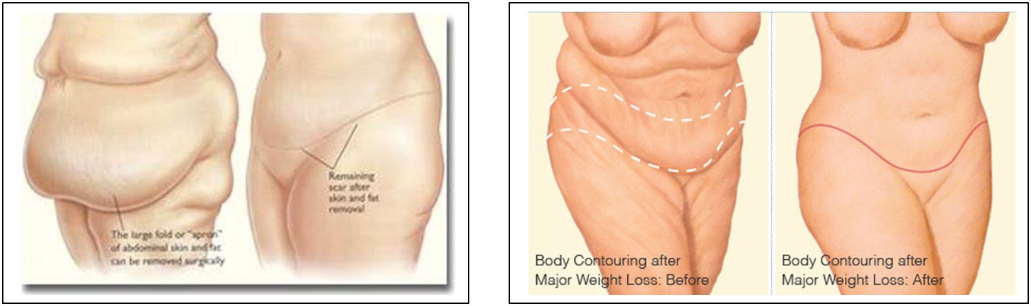 Obesitas Kliniek Dr. Lemmens